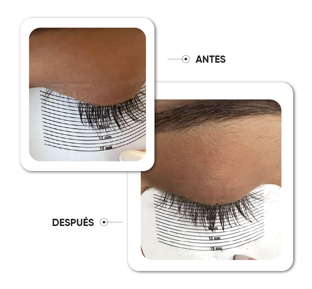 Antes y después · Caso 3
