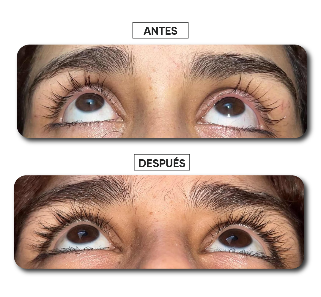 Antes y después · Caso 8