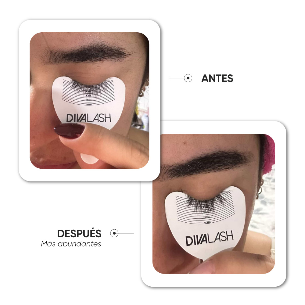 Antes y después · Caso 7