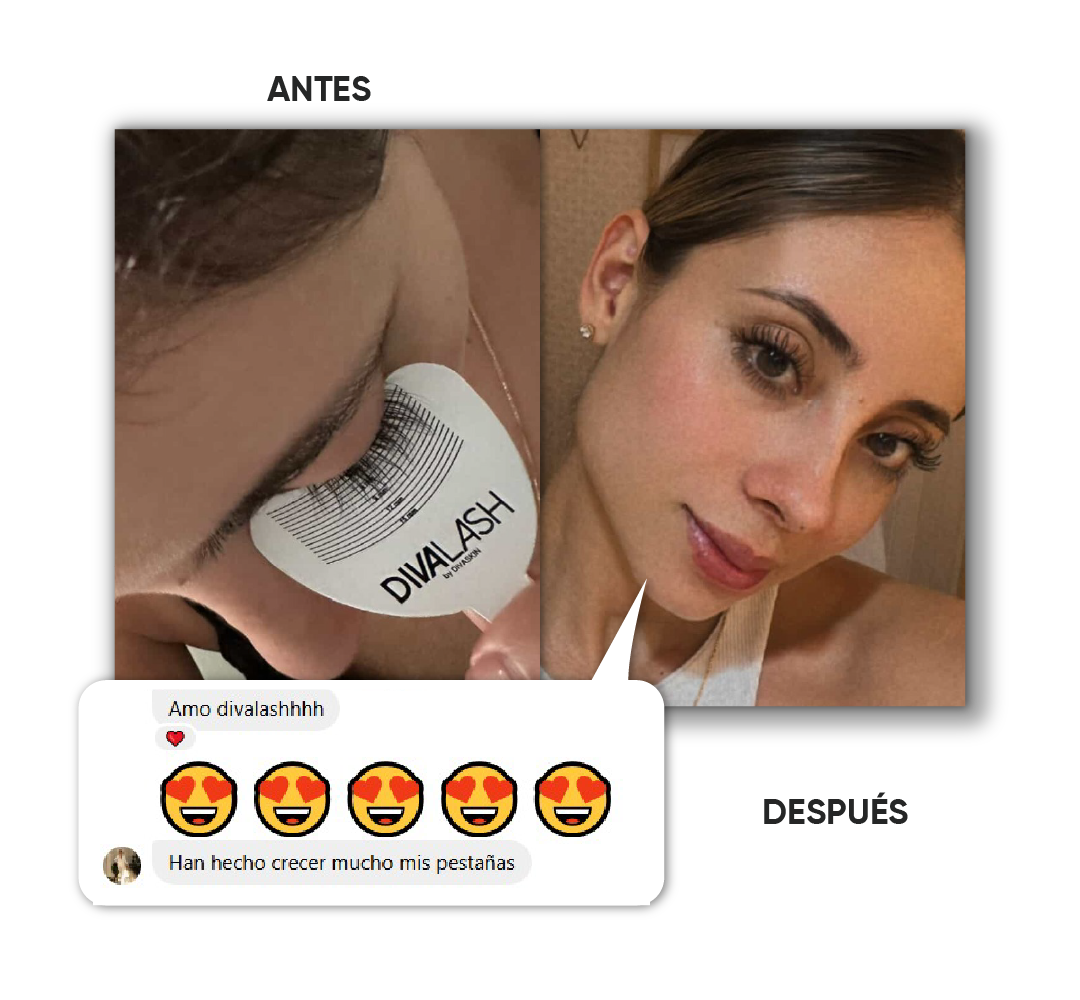 Antes y después · Caso 2